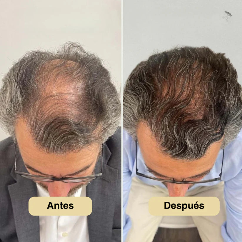 Roll-on de Crecimiento Capilar StyleofYou™