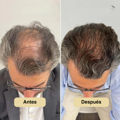 Roll-on de Crecimiento Capilar StyleofYou™