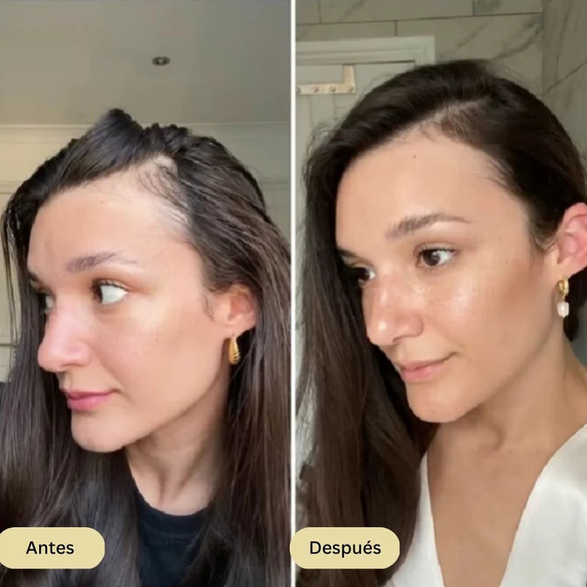 Roll-on de Crecimiento Capilar StyleofYou™