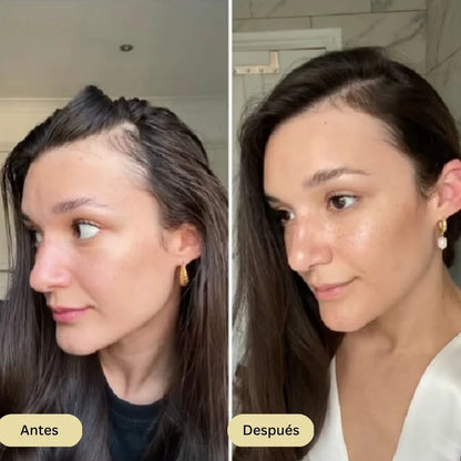 Roll-on de Crecimiento Capilar StyleofYou™