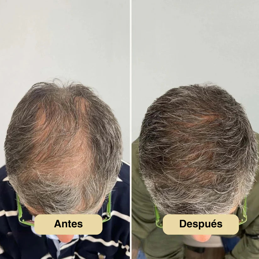 Roll-on de Crecimiento Capilar StyleofYou™